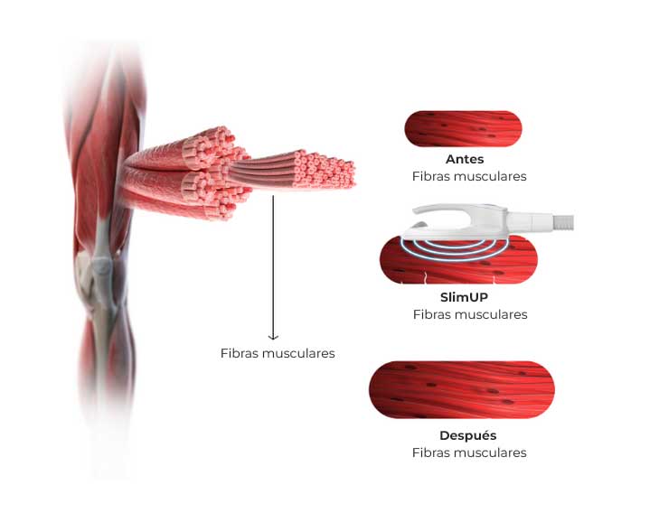 slimup fibras musculares